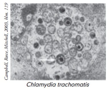 Chlamydias