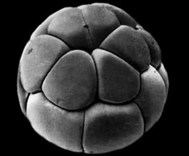 Bentuk morulla pada embrio manusia
