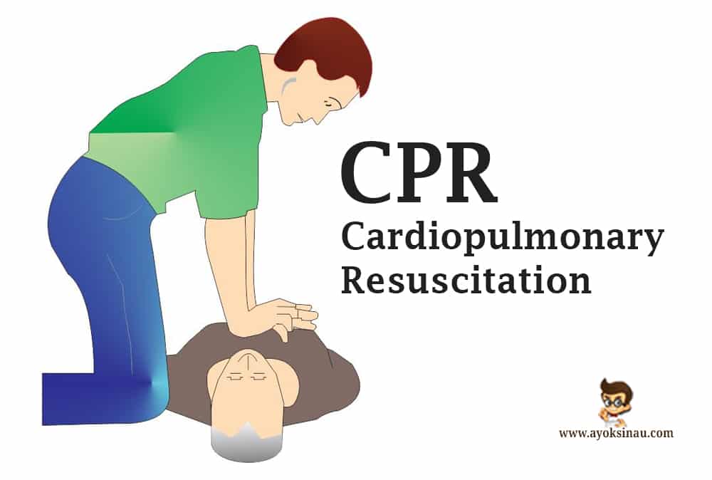 Resuscitate maksud Cardiopulmonary resuscitation